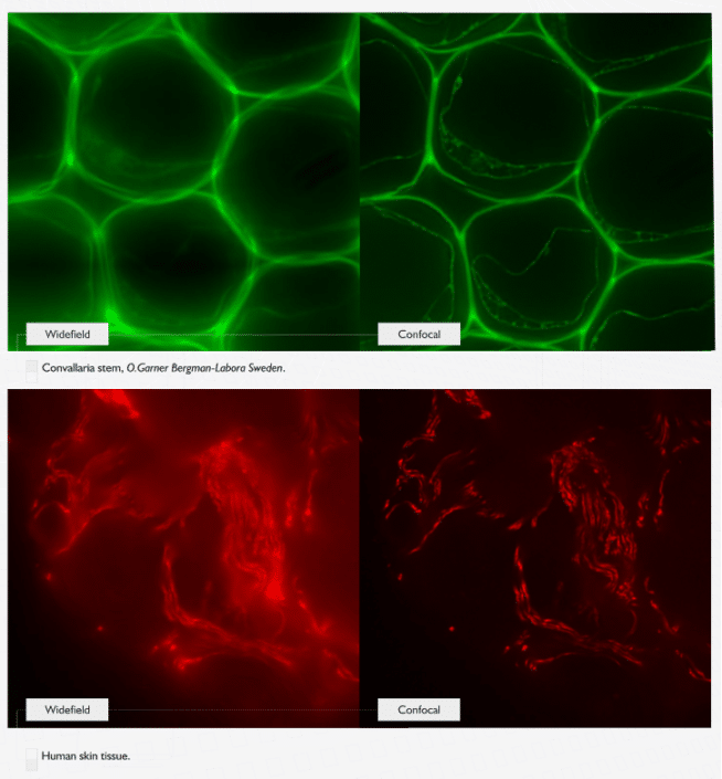 Spinning Disk Microscopy › Rapp OptoElectronic